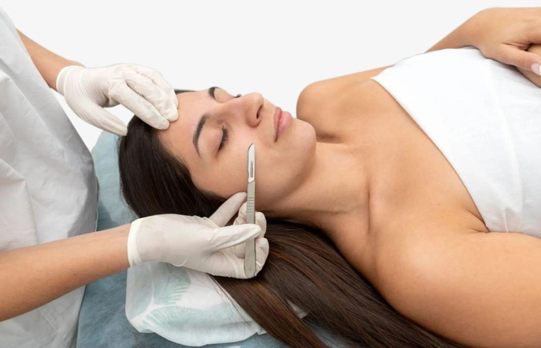 Microneedling and Dermaplaning being done on a woman face