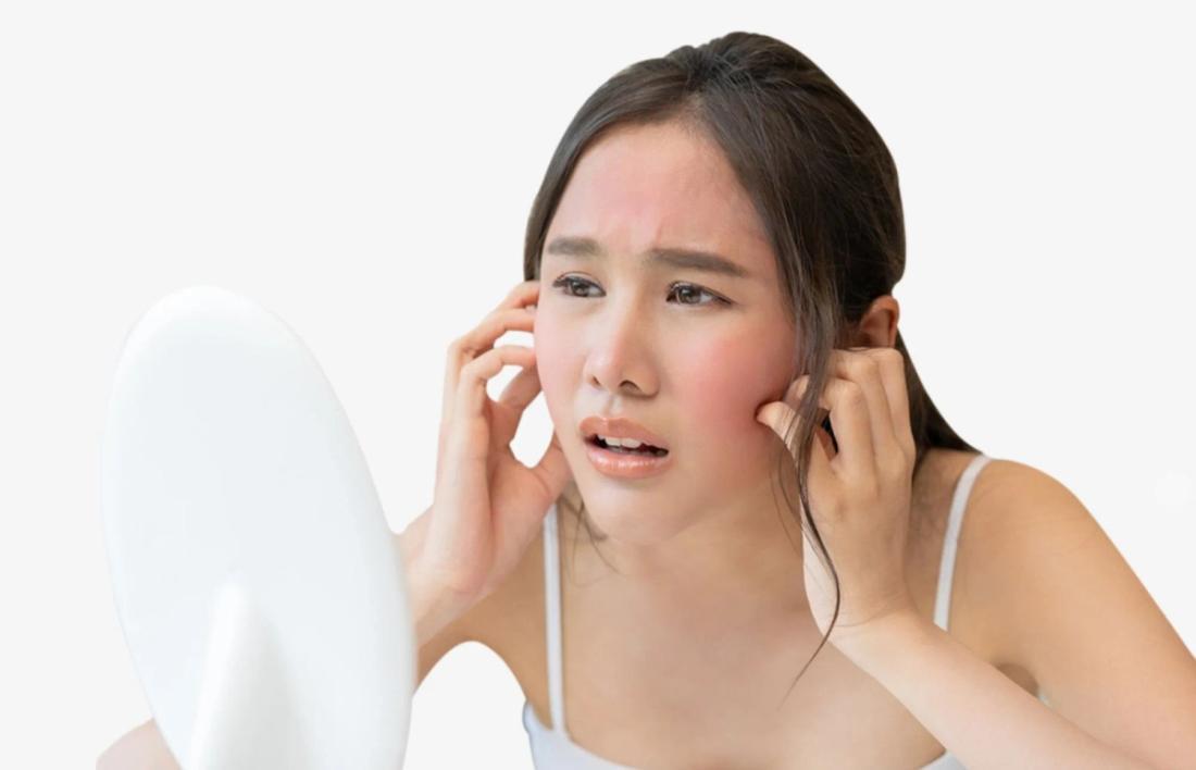 A woman having rashes on ear and difficult in breathing