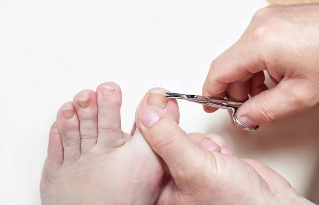 trim your toenails